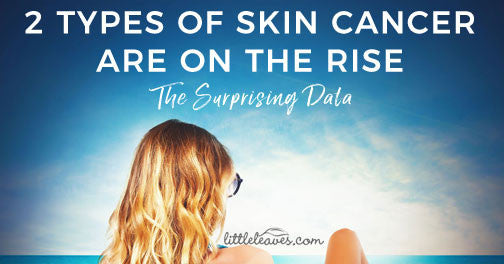2 Types of Skin Cancer Are on the Rise
