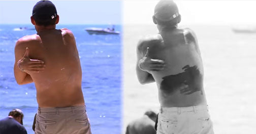 Skin Cancer Awareness - Who's Got Your Back?