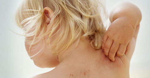 Clothing for Sensitive Skin Helps Alleviate Irritation