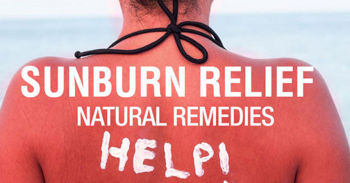 Sunburn Relief - Natural Remedies