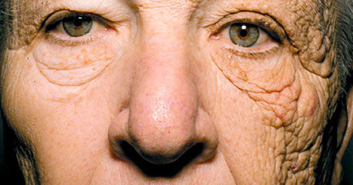 Dramatic Photo Reveals Sun's Effect on Skin