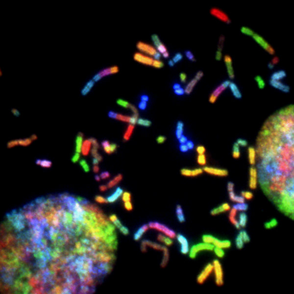 How Genetics Contribute to Skin Cancer Risk and How to Prevent It